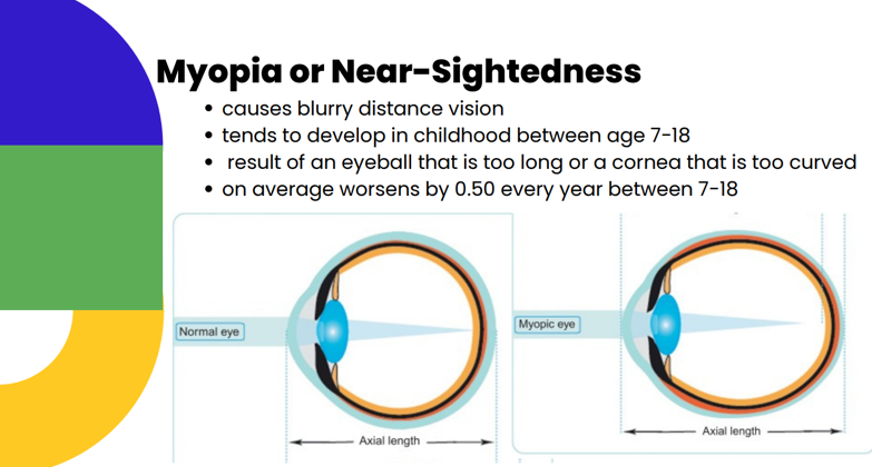 myopia or near-sightedness illustration